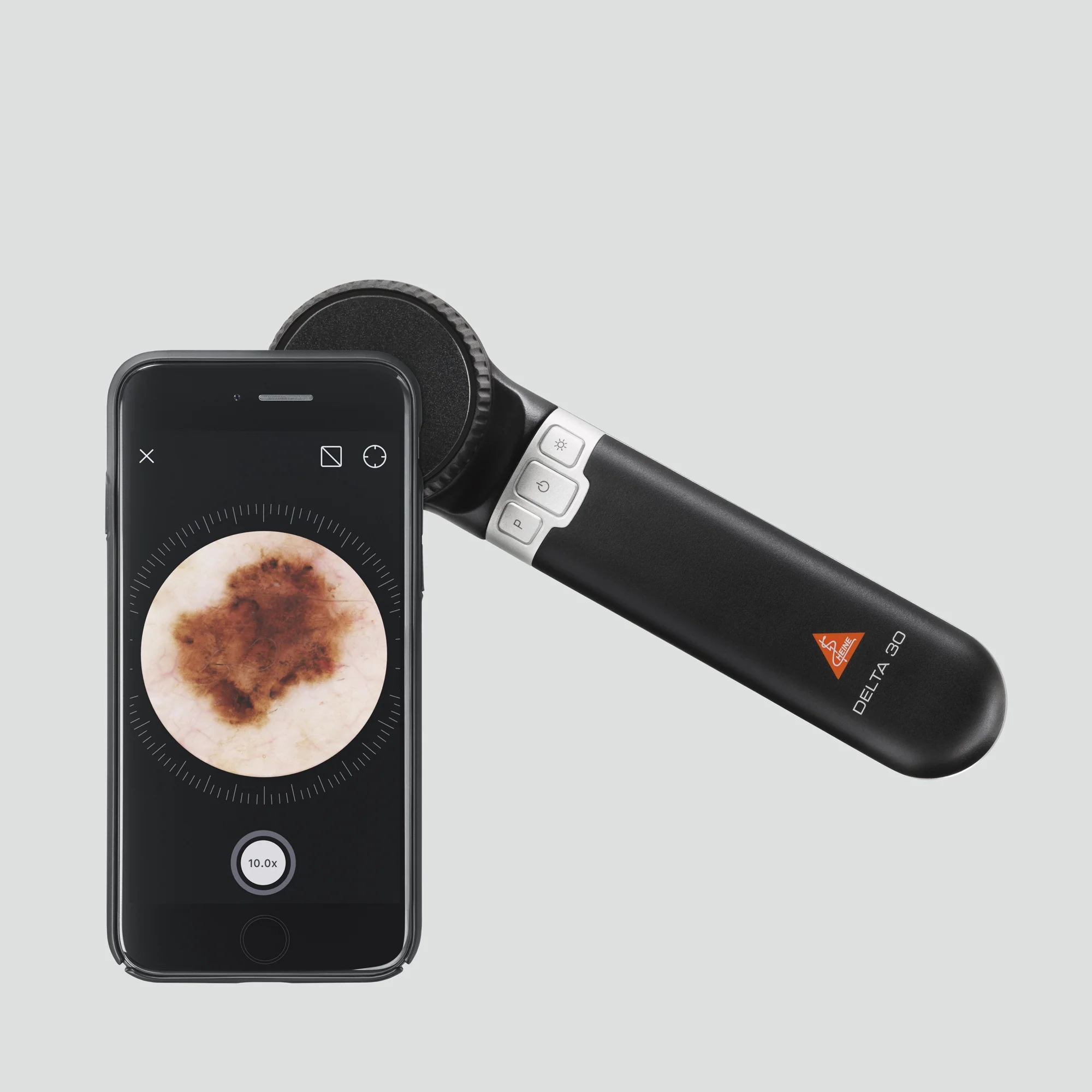 HEINE DELTA 30 Dermatoscope - Image 5